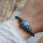 Keramik Armband